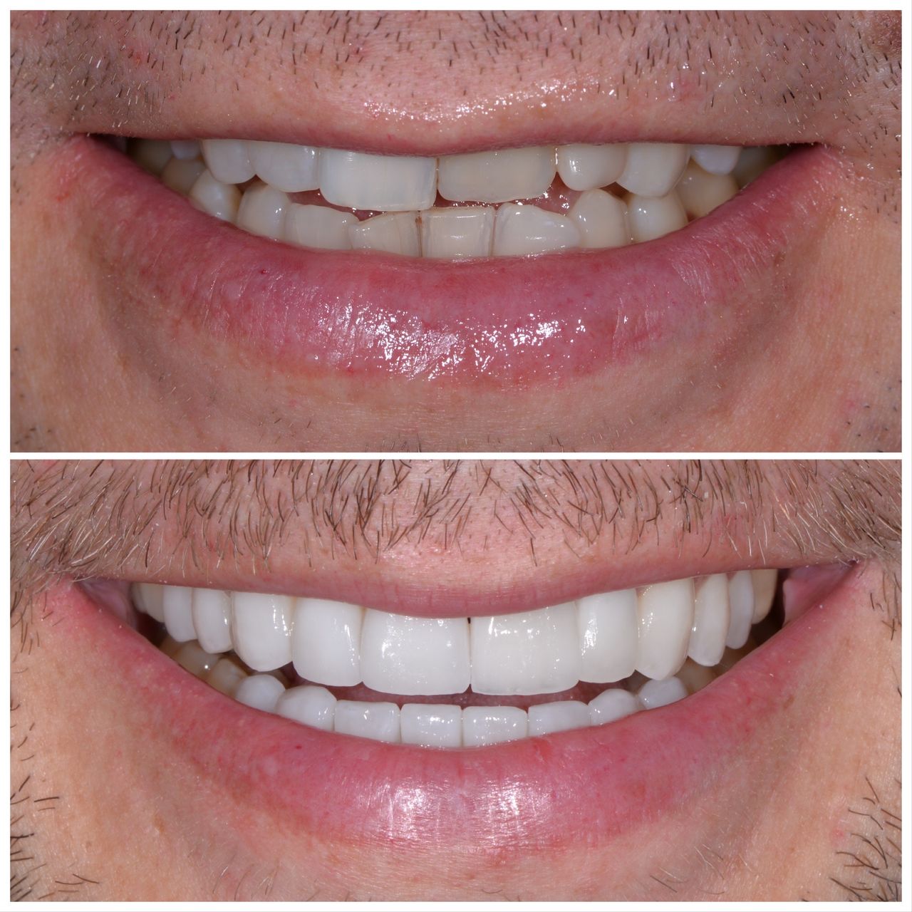 Martin Bartoszcze-39