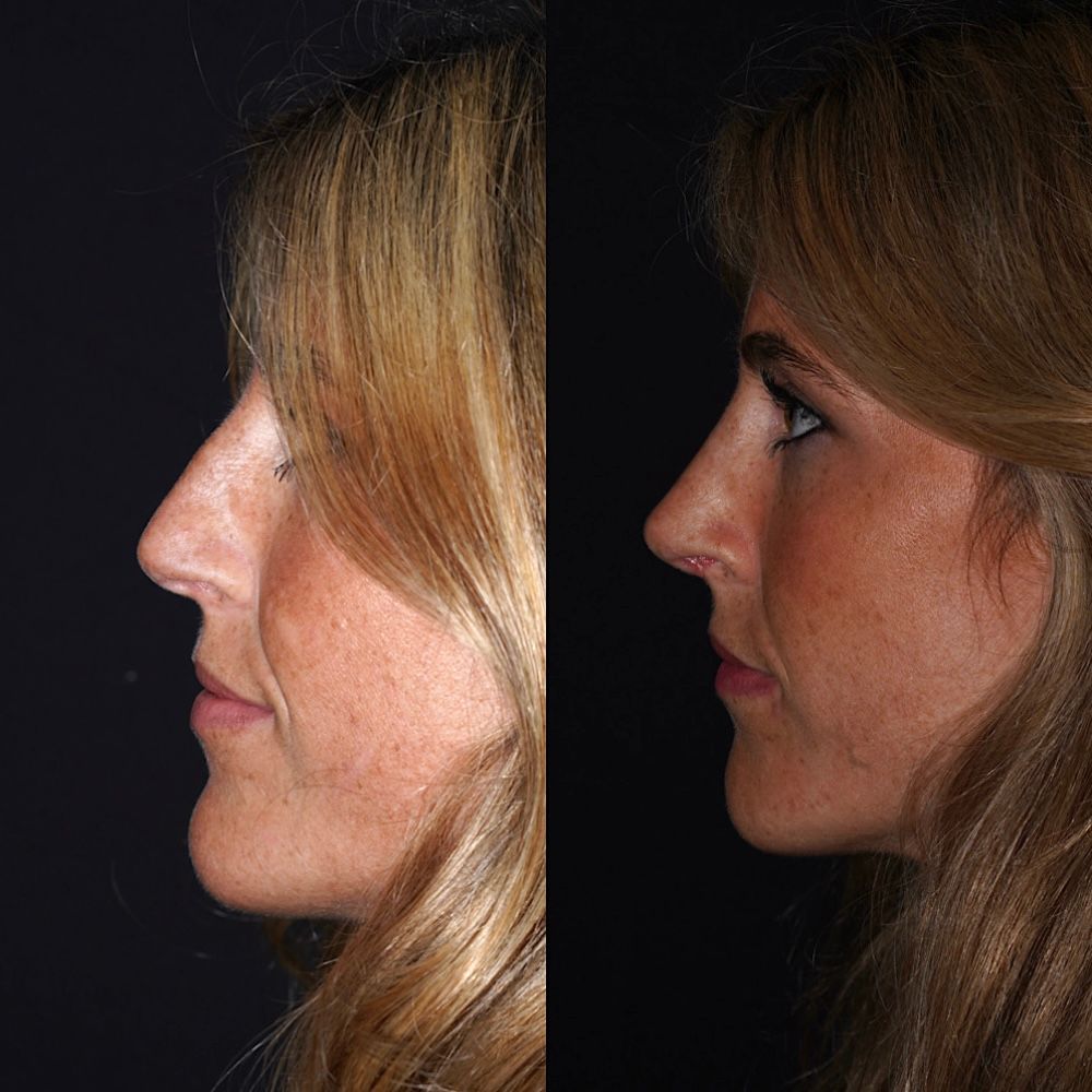 Alfonso Campos Gonzalez-4