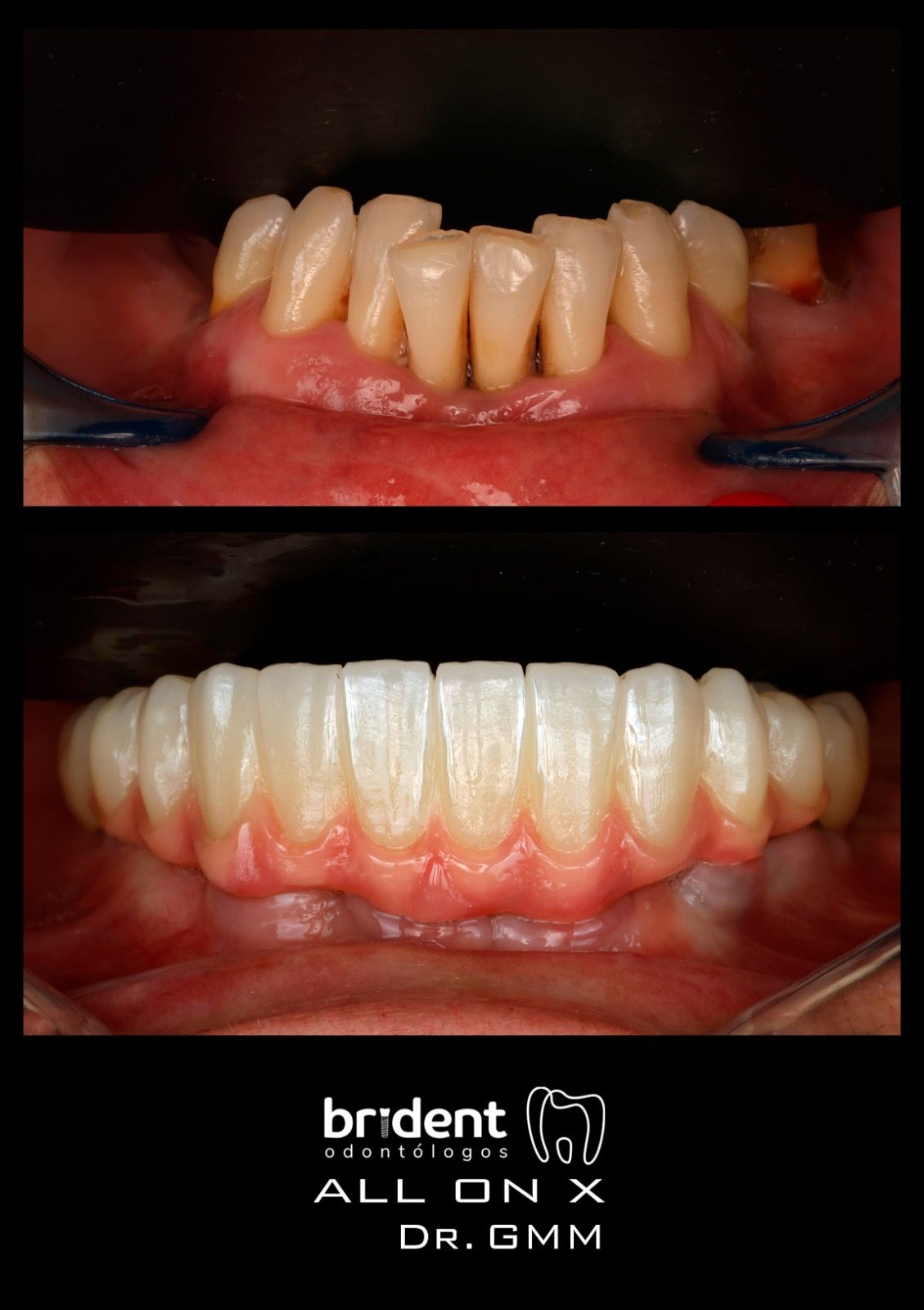 Guillermo Moreno Masiá-88