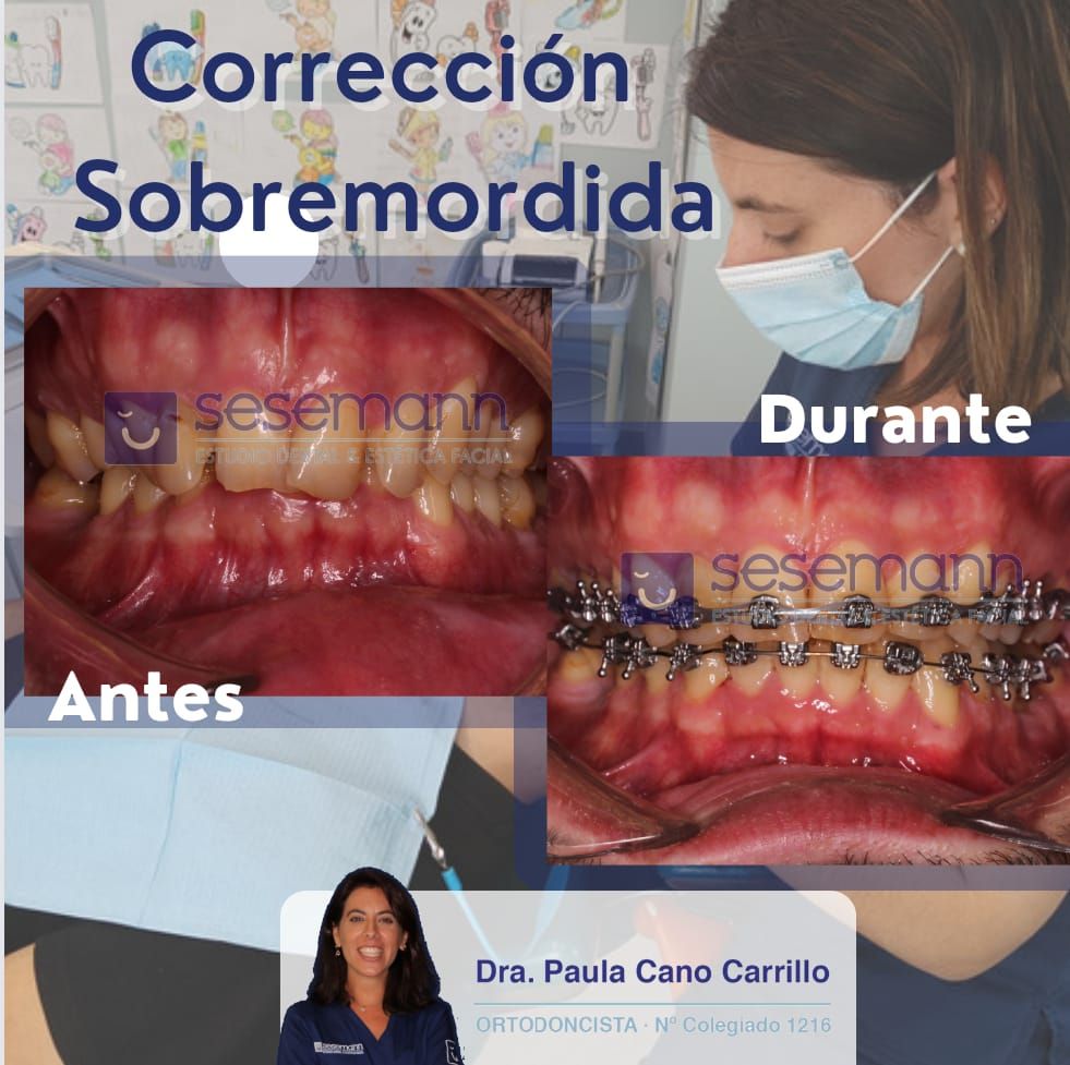 Paula Cano Carrillo-17