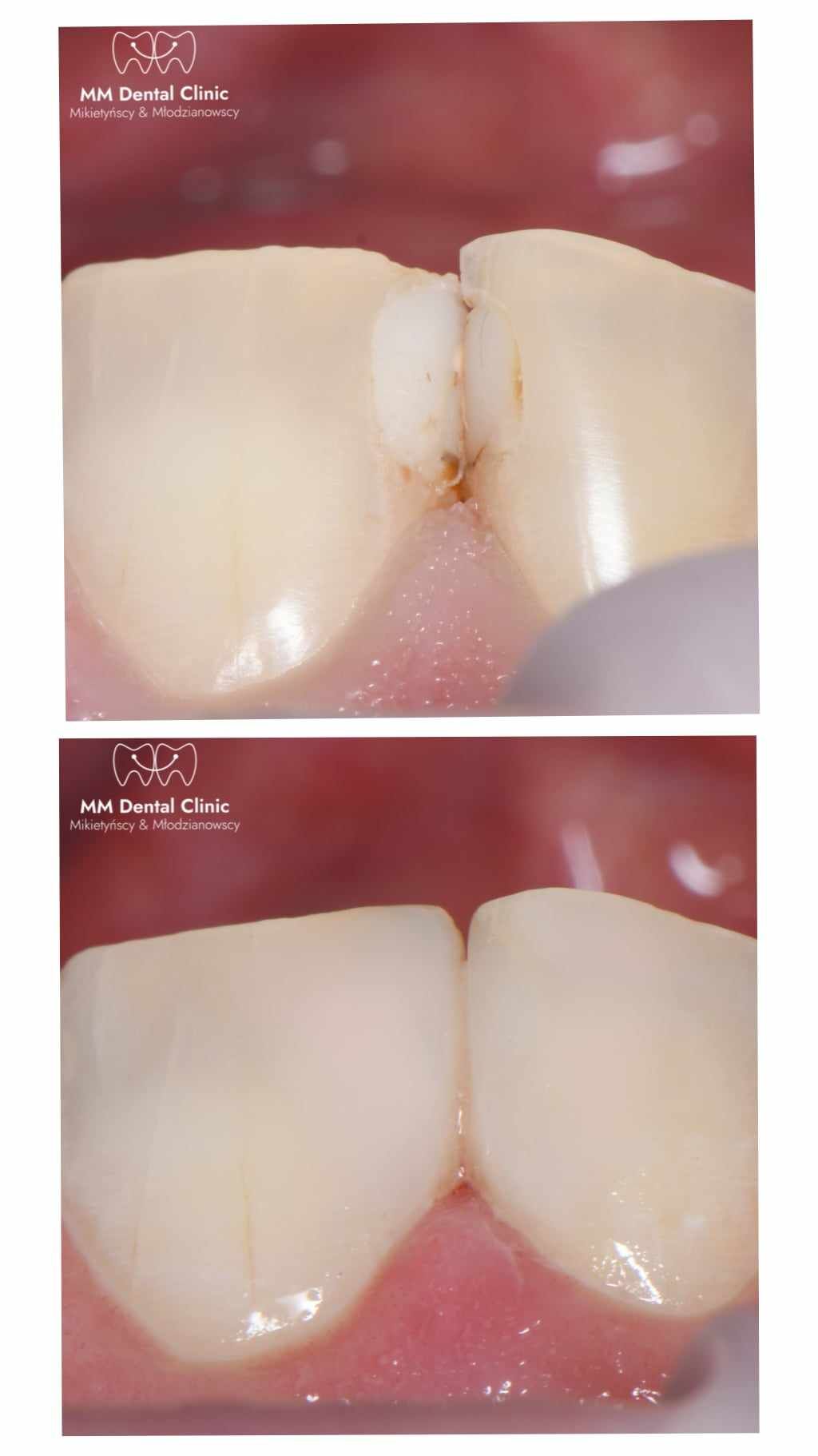 Damian Benbenkowski-6