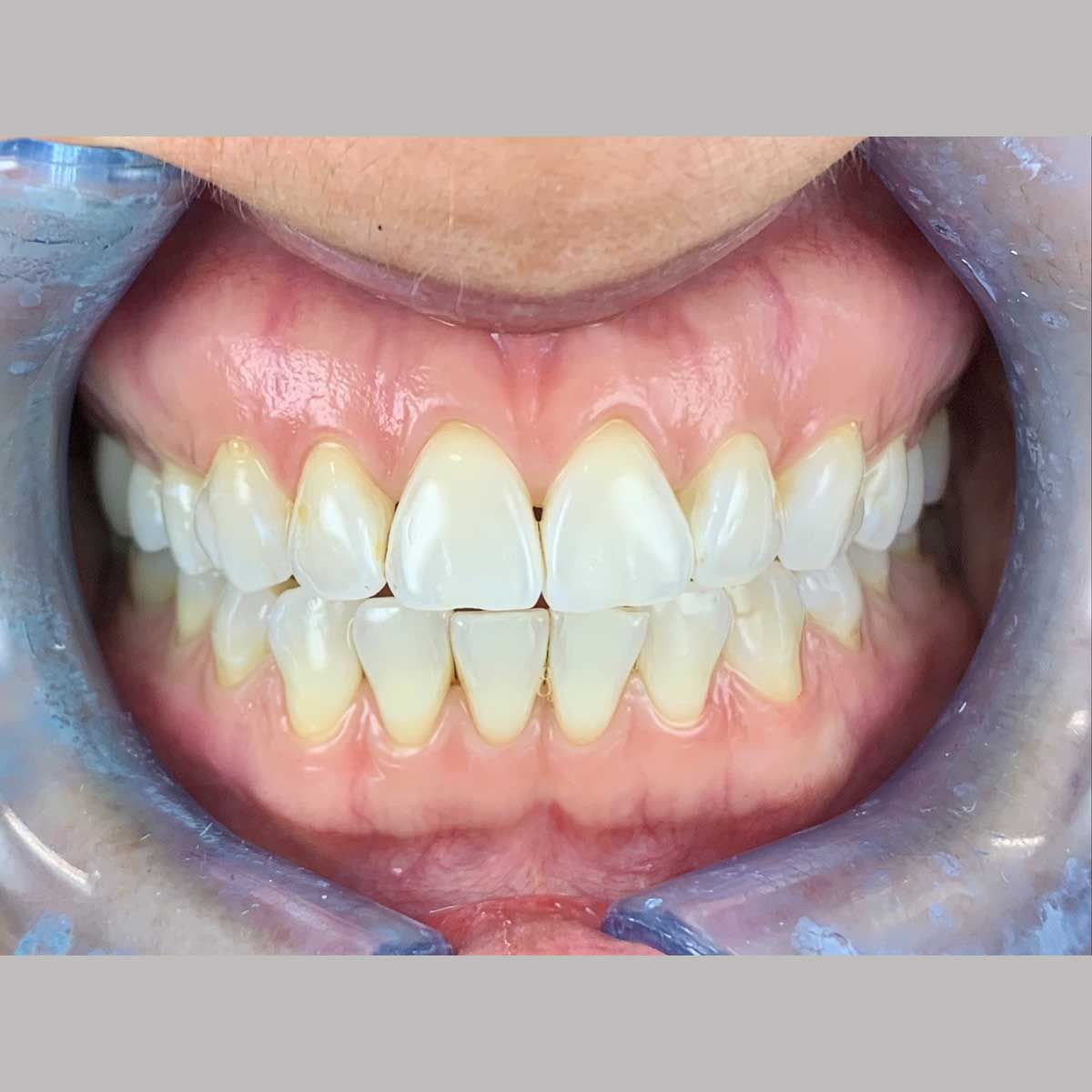 Gianluigi Bittante-46