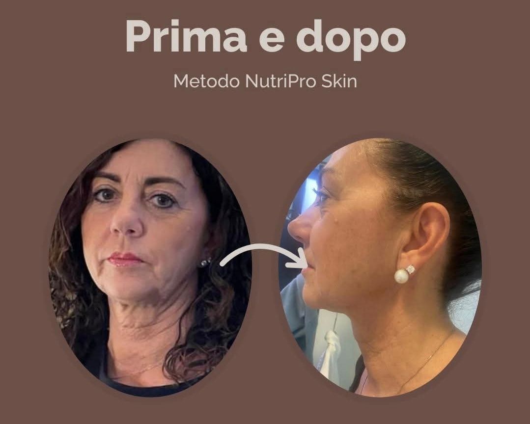 Guglielmina Chinaglia-3