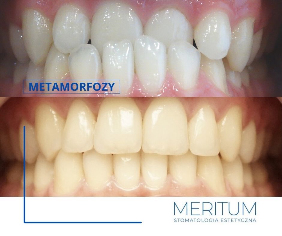 Michał Ostrowski-10