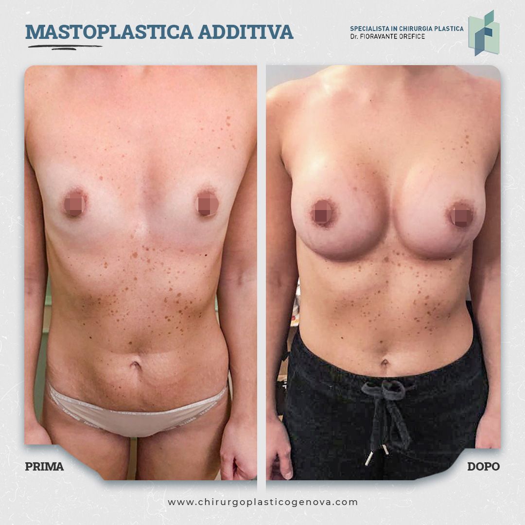 Fioravante Orefice-13