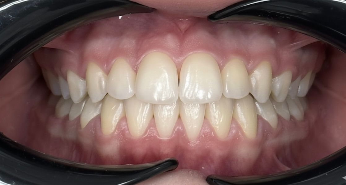 Francesco Sorrentino-2