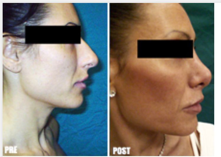 Pasquale Virciglio-22