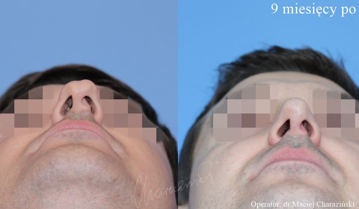 Maciej Charaziński-44