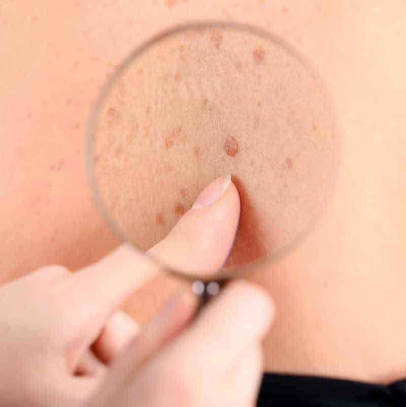 Katharina Schuppert-6