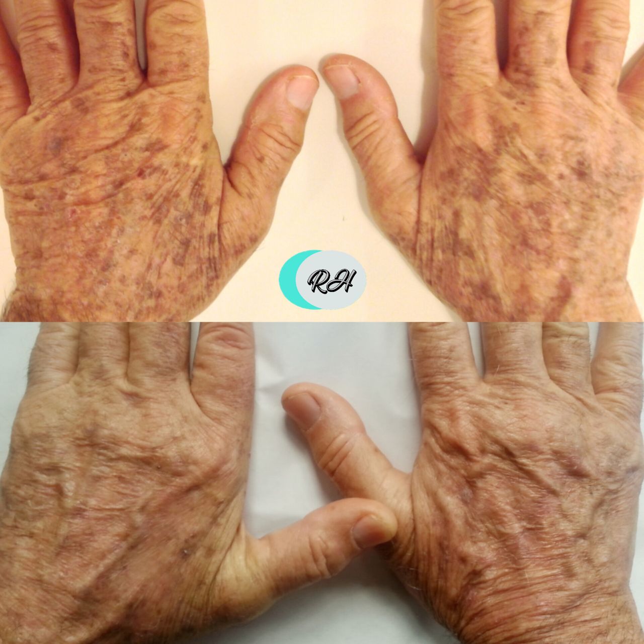 Rosalba Herrero Zerpa-102