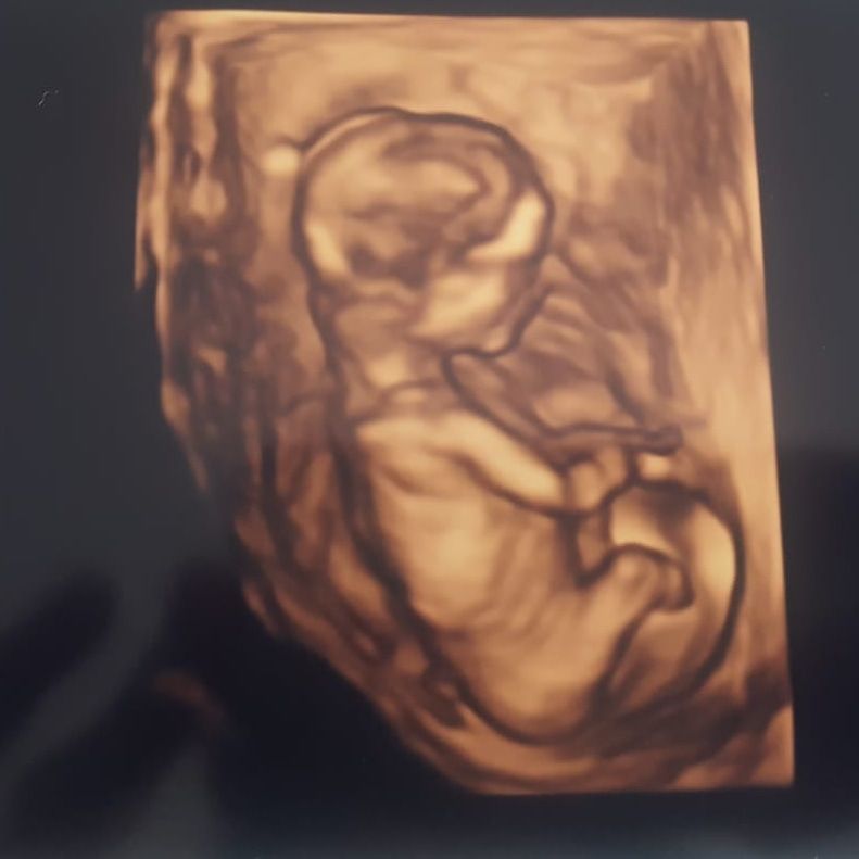 Servet Şekeryapan Çalıkoğlu-2