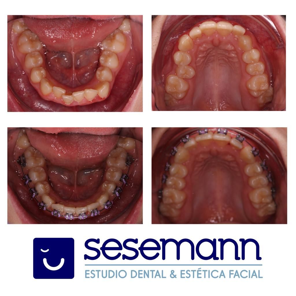 Paula Cano Carrillo-119