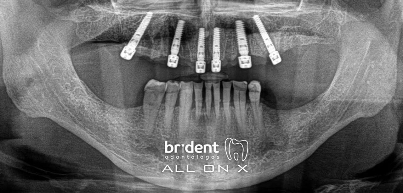 Guillermo Moreno Masiá-50