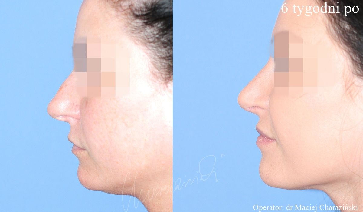 Maciej Charaziński-82