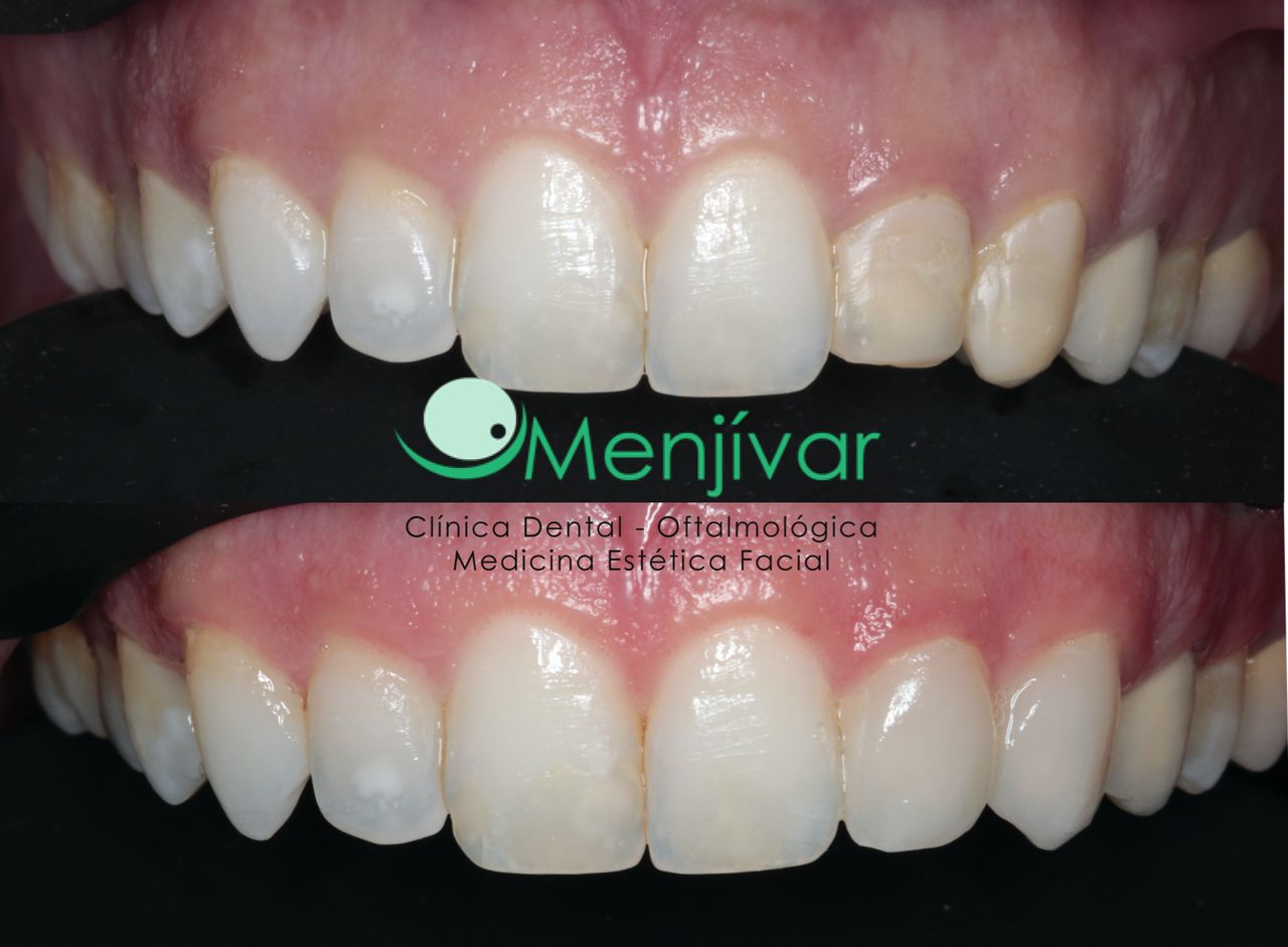 Ana Menjívar Galán-3