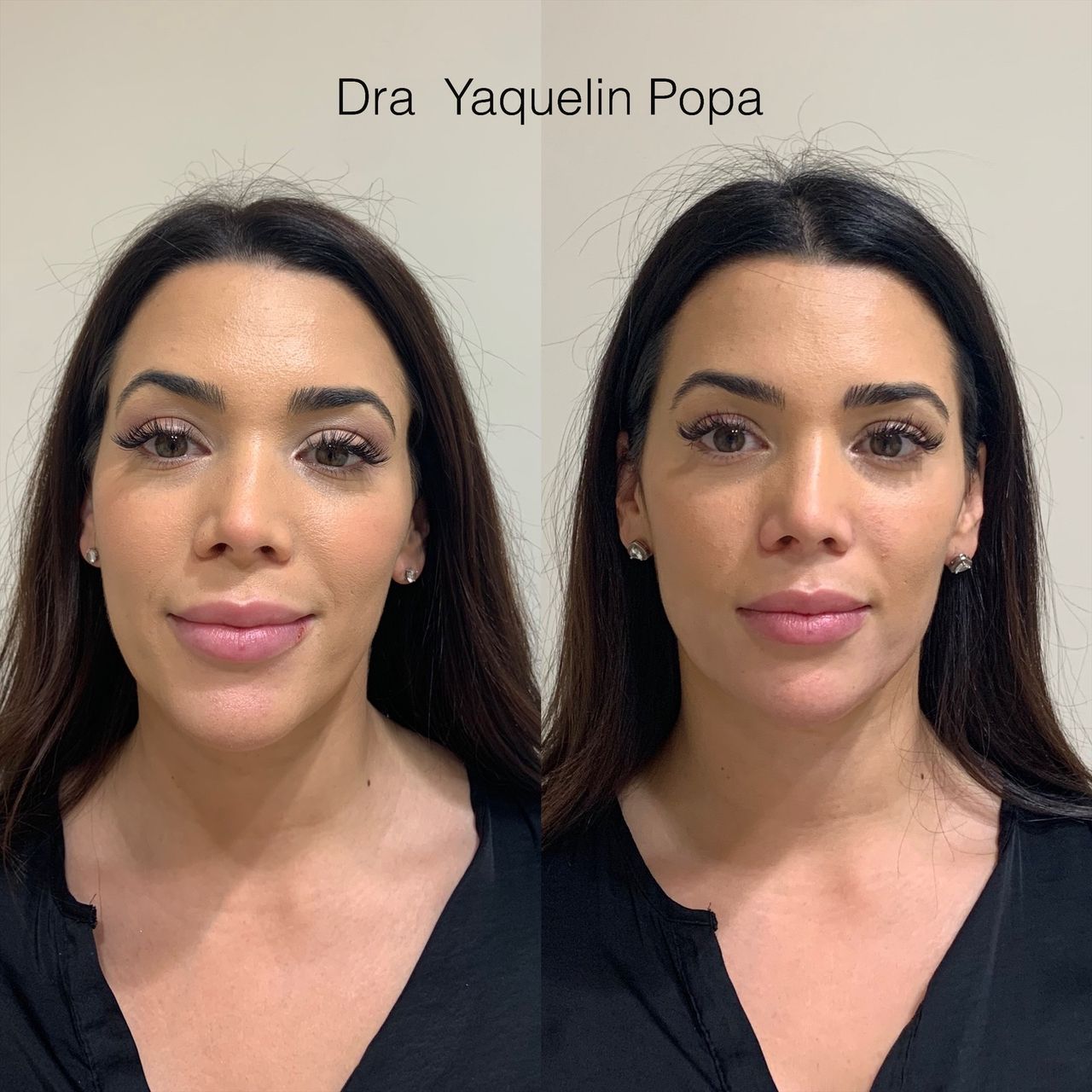 Yaquelin Popa Rosales-5