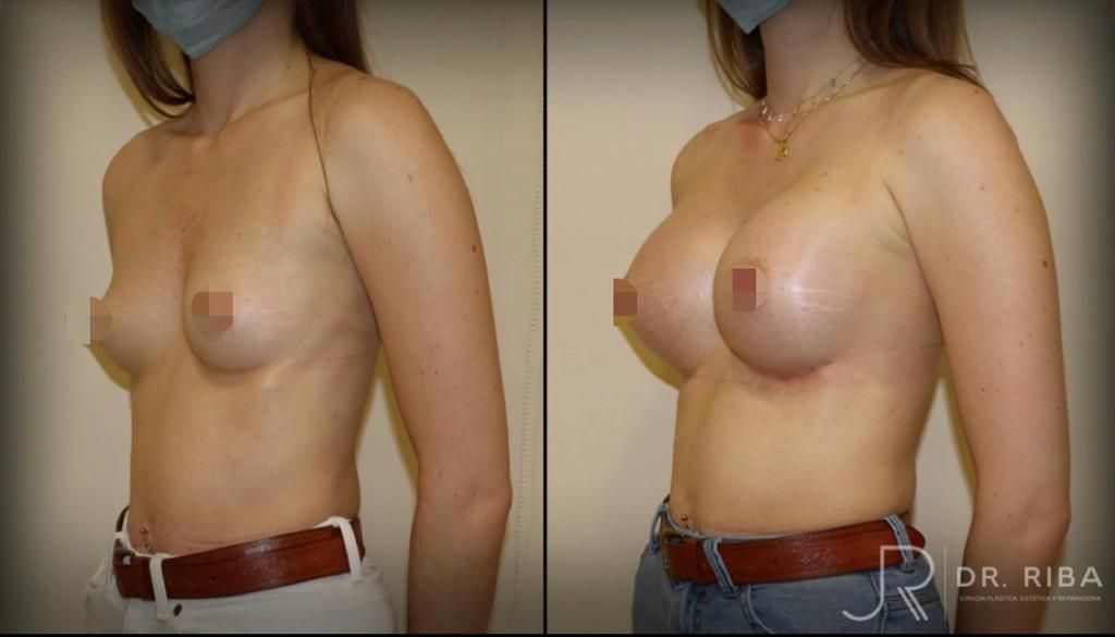 Jordi Riba Vilchez-59