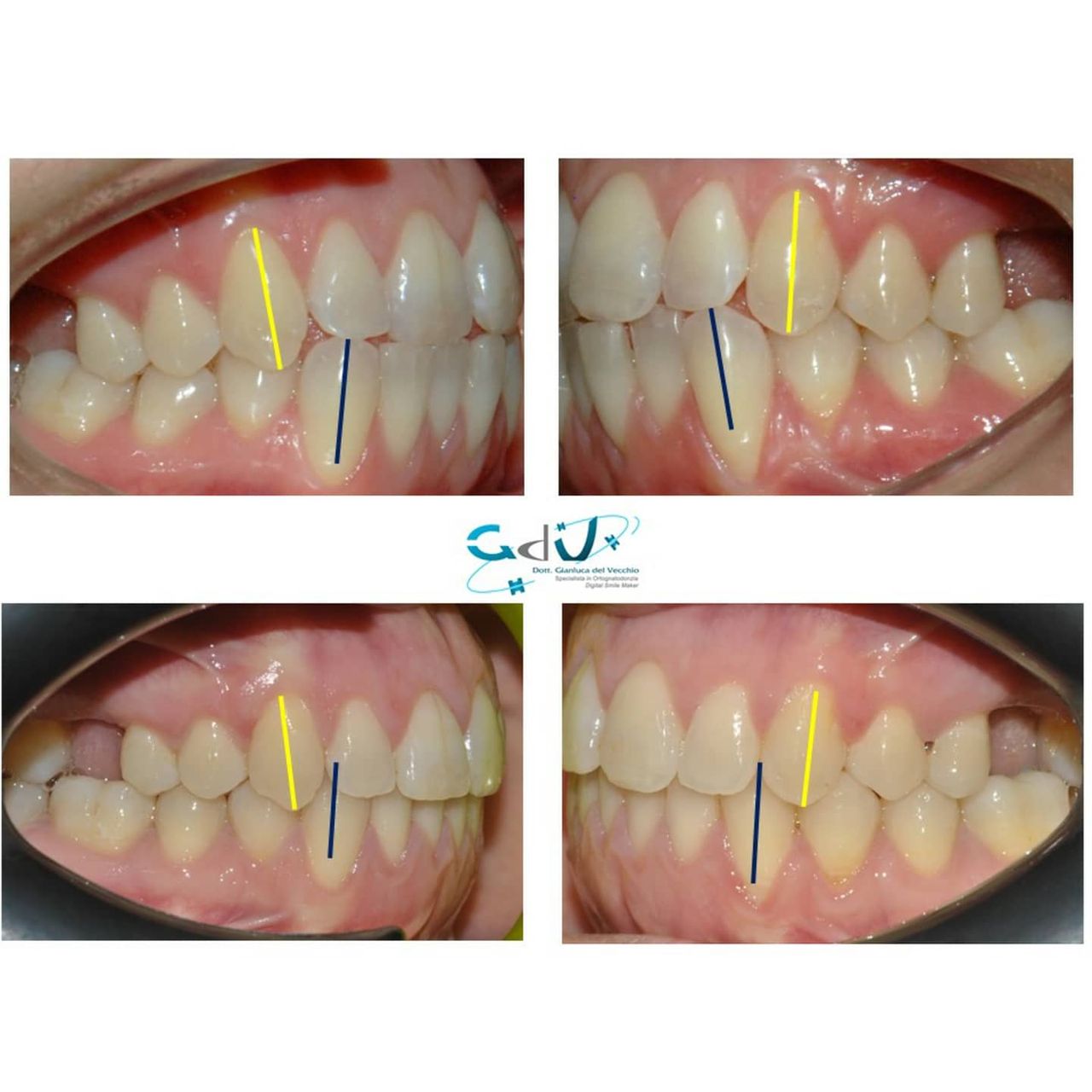 Gianluca Del Vecchio-105