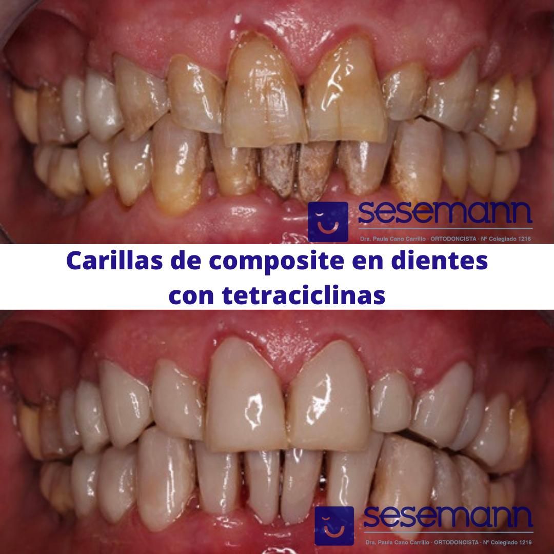 Paula Cano Carrillo-81