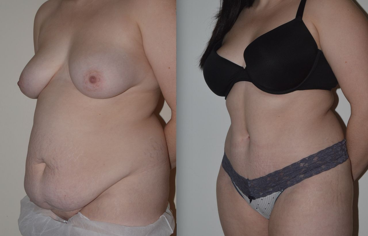 Michele Antonacci-11