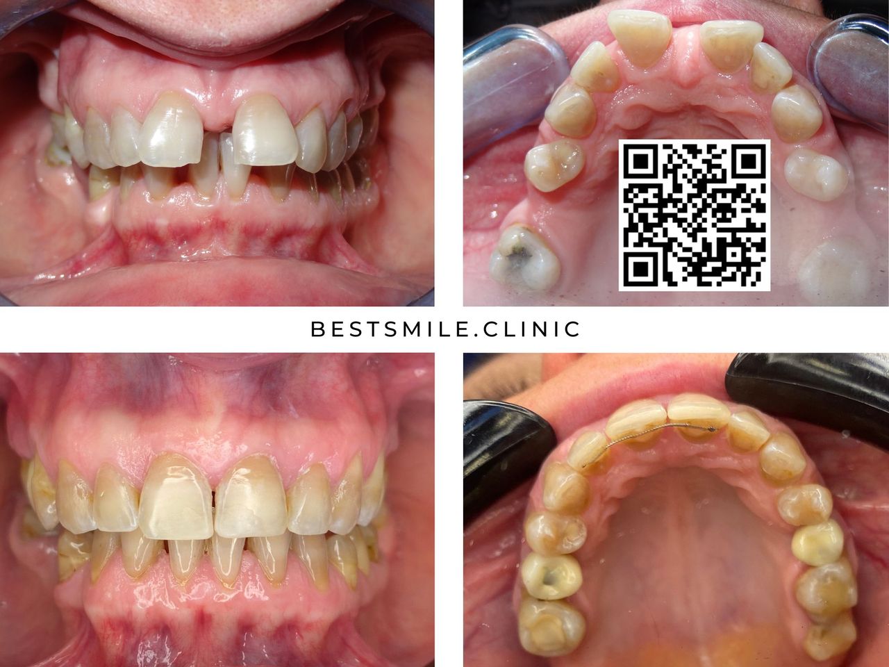Sylwester Burchacki-4