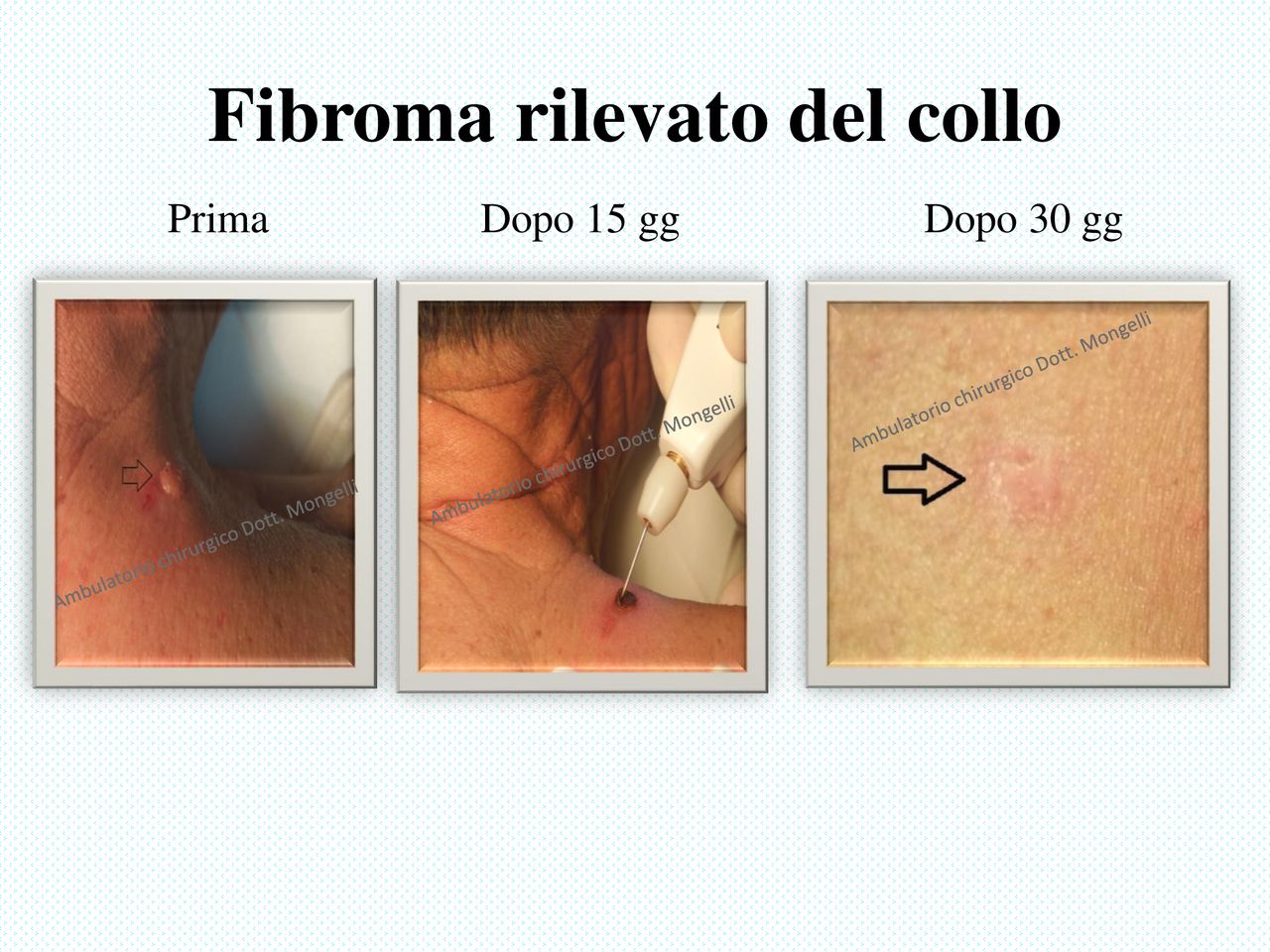 Matteo Antonio Mongelli-11