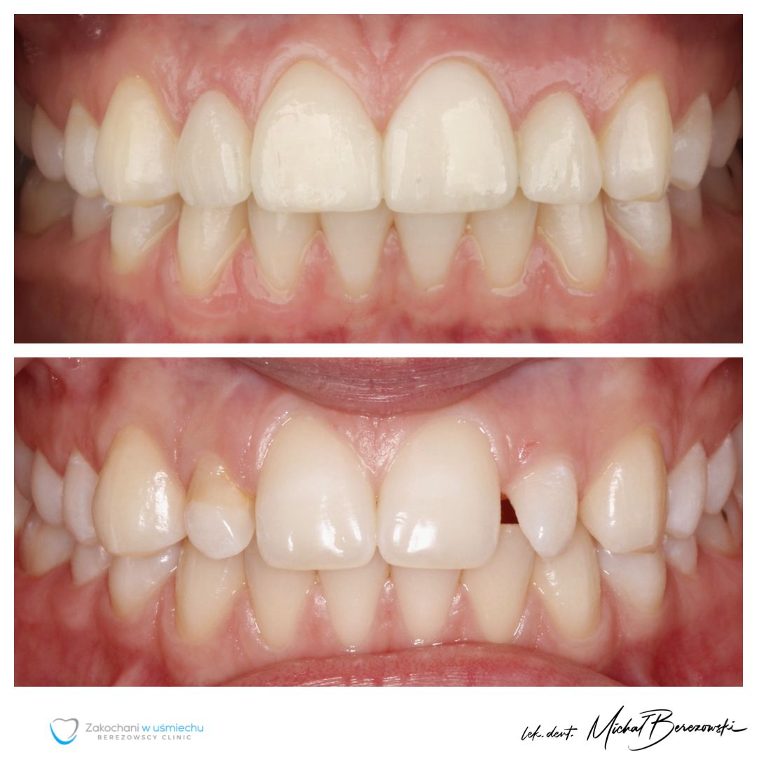 Michał Berezowski-45