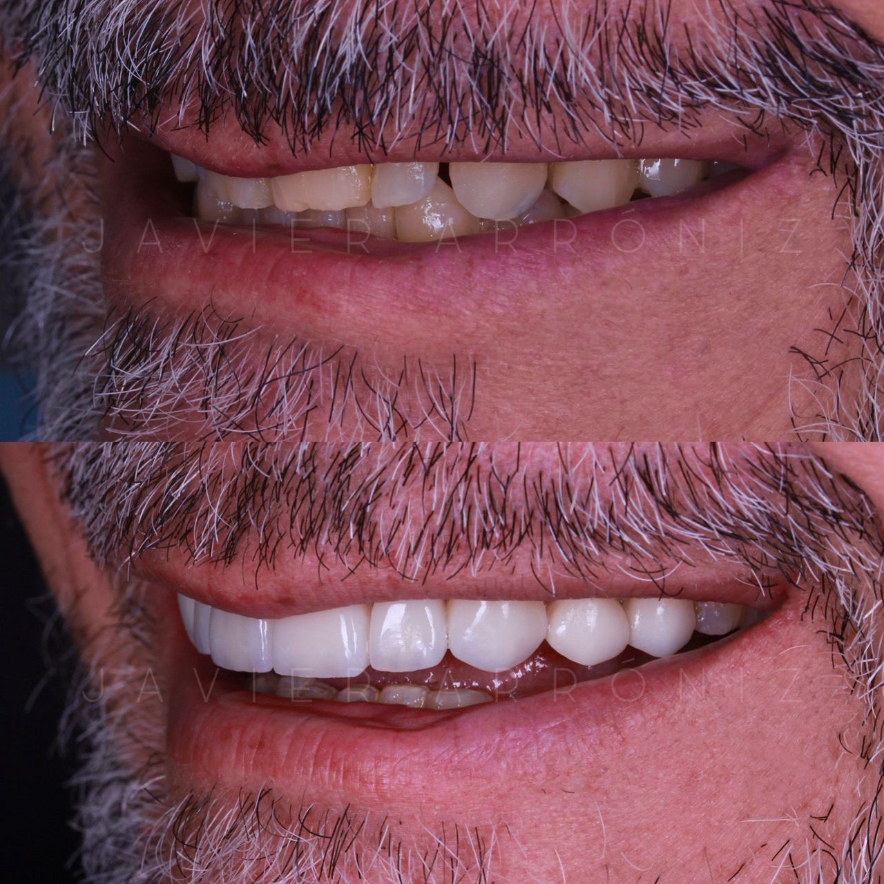 Javier Arroniz Gallego-2