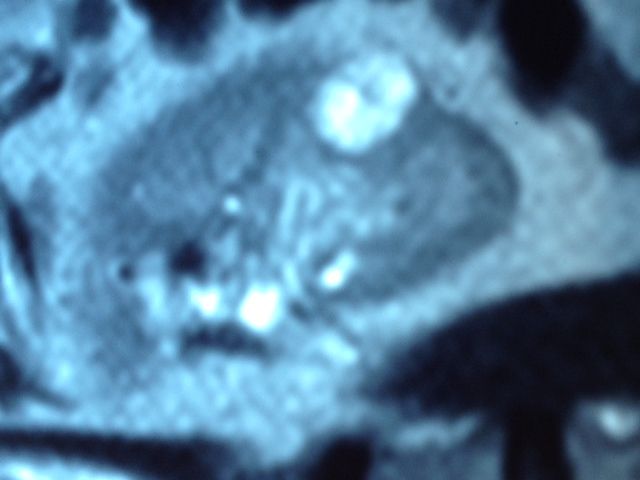 Francesco Mastroeni-15