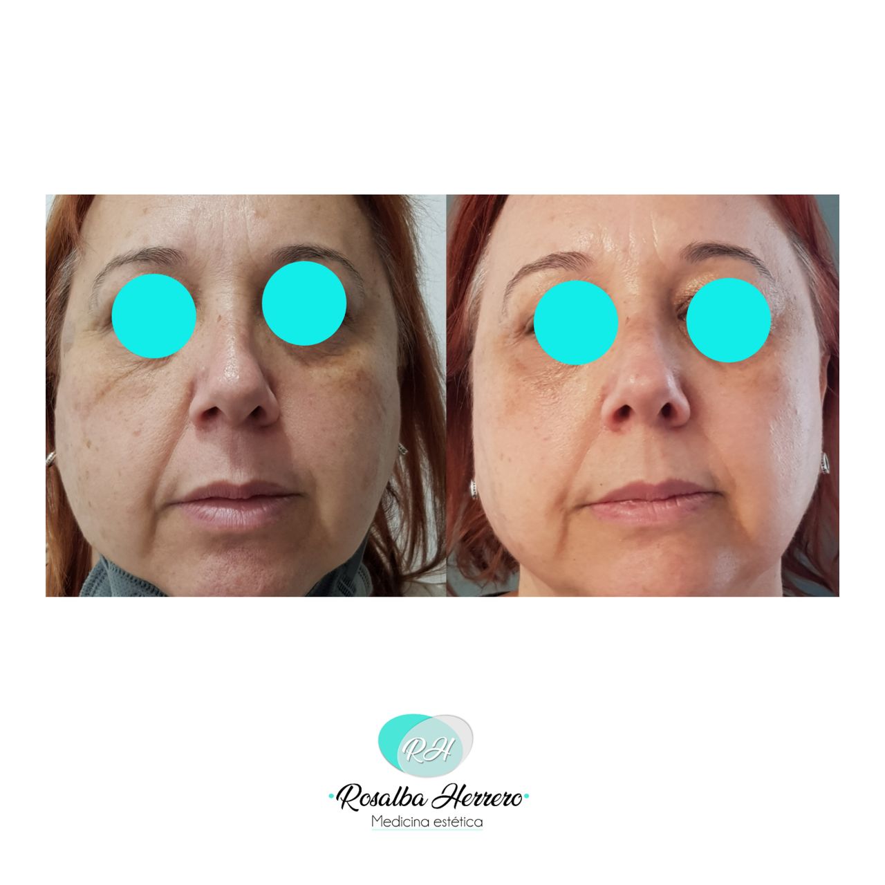 Rosalba Herrero Zerpa-181