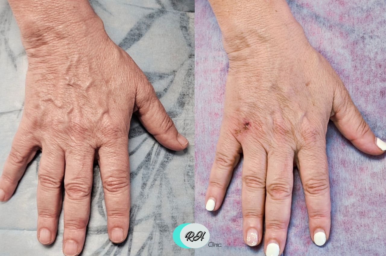 Rosalba Herrero Zerpa-615