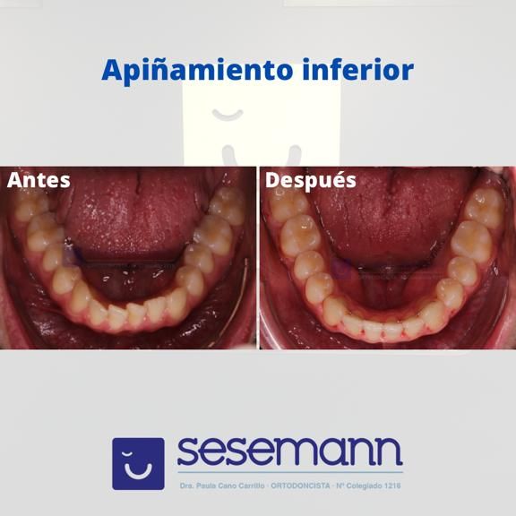 Paula Cano Carrillo-54