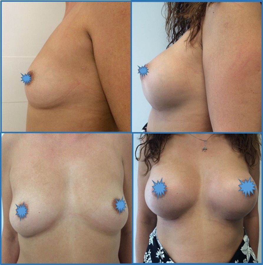 Giorgio Giovannelli-15