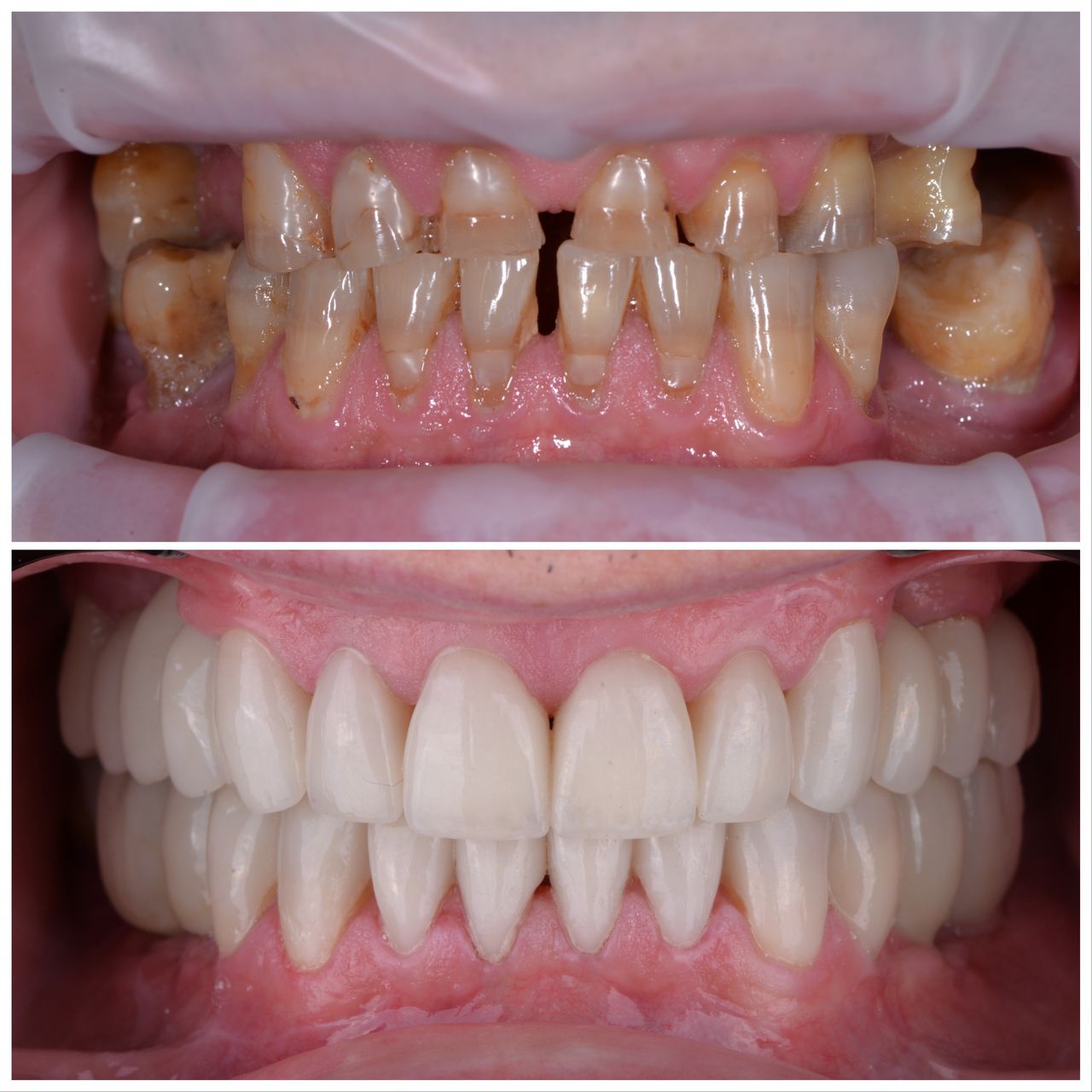 Martin Bartoszcze-33