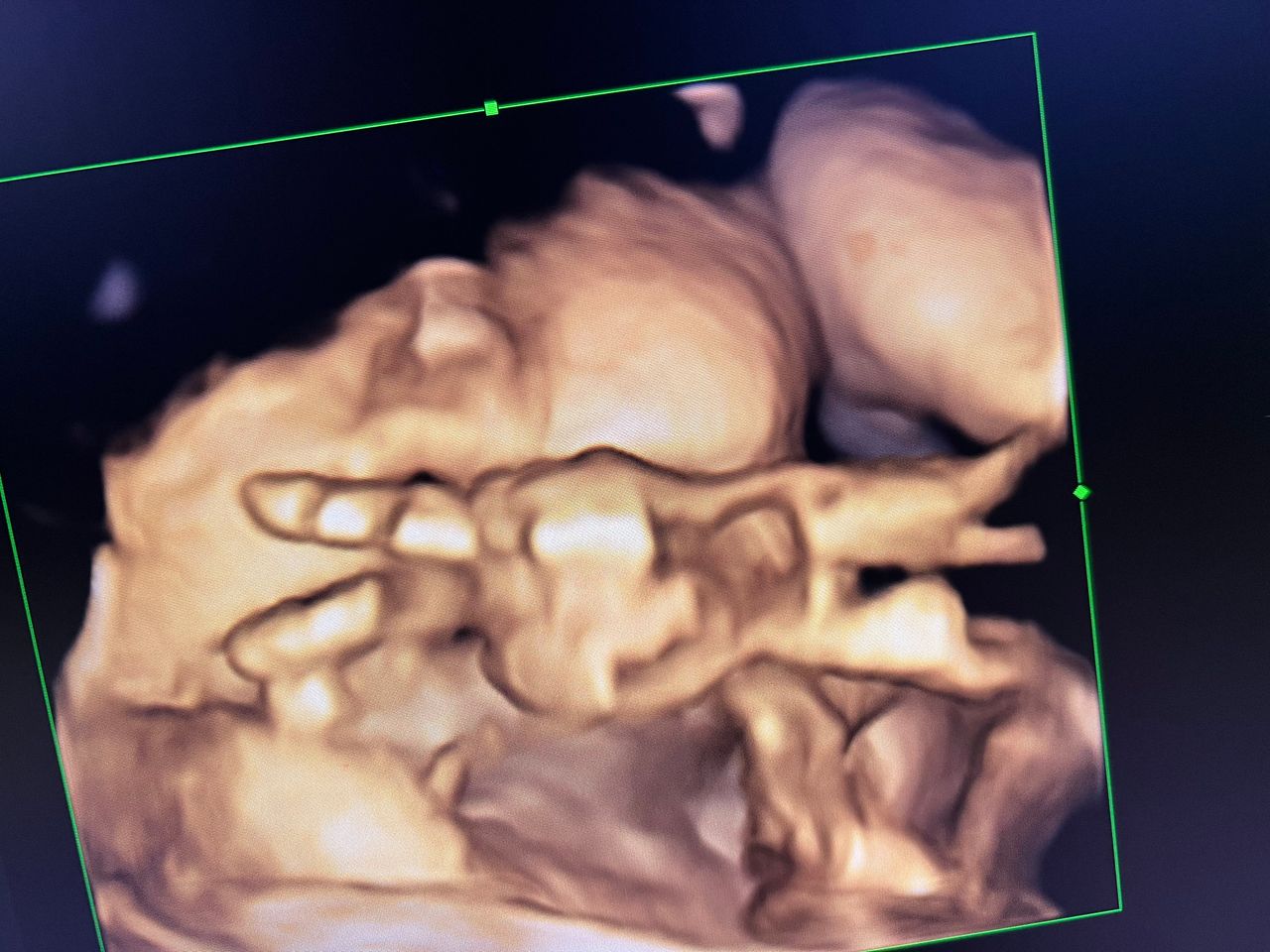 Magdalena Ziętara-1