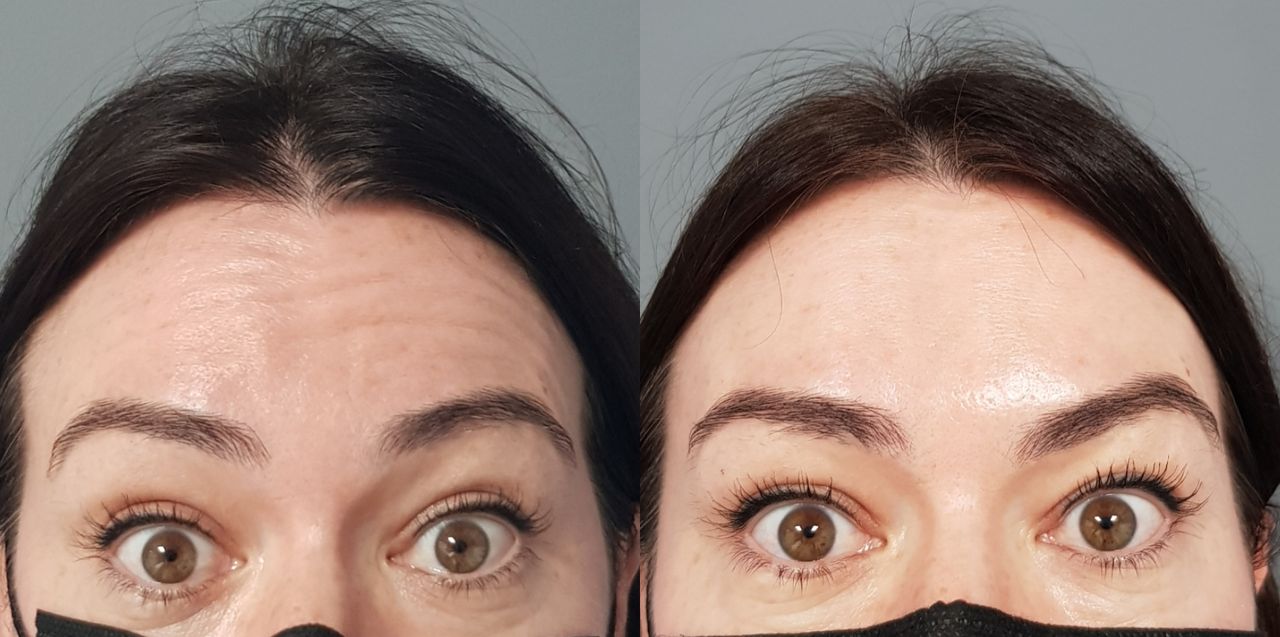 Rosalba Herrero Zerpa-118