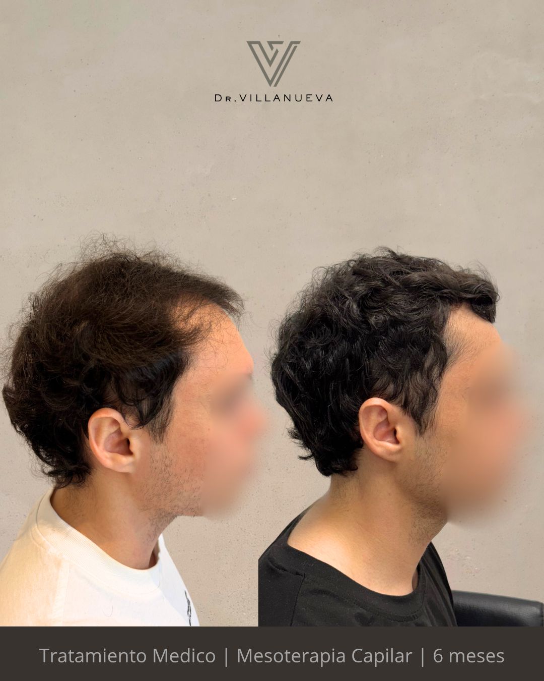 Alfredo Villanueva-15