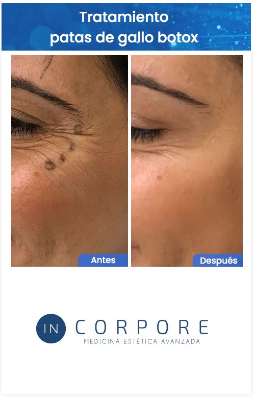 Juan Enrique Pérez Enríquez-134