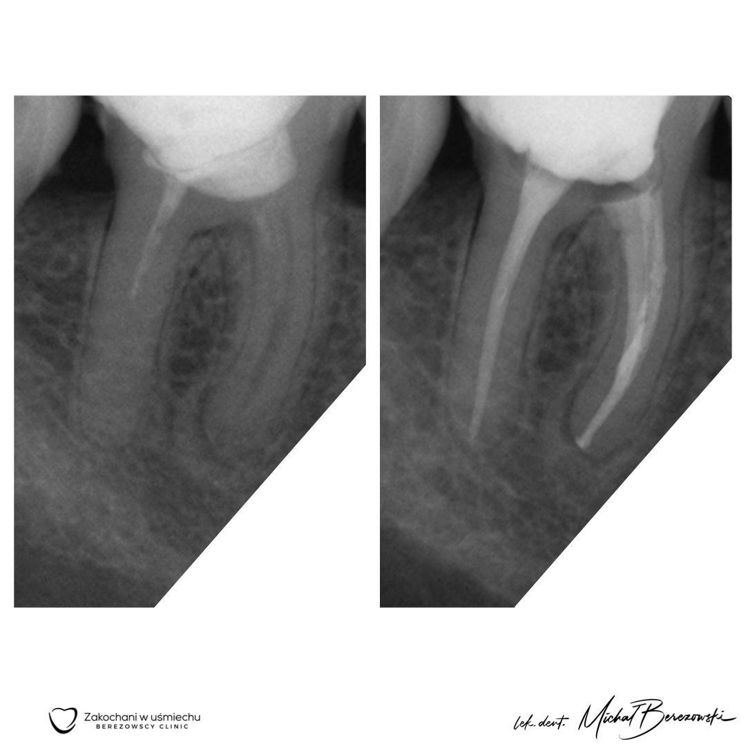Michał Berezowski-40
