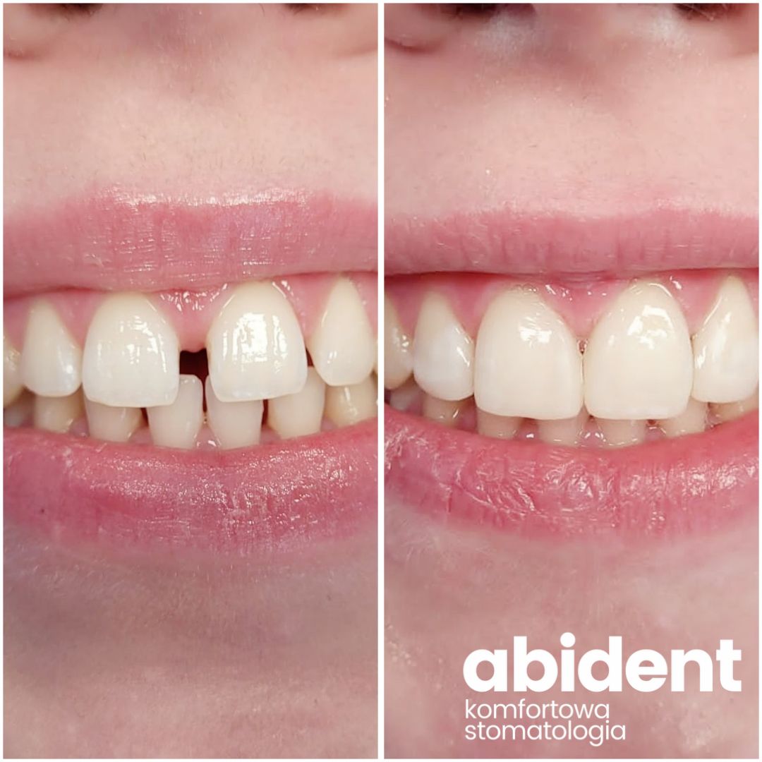 Katarzyna Korfanty-1