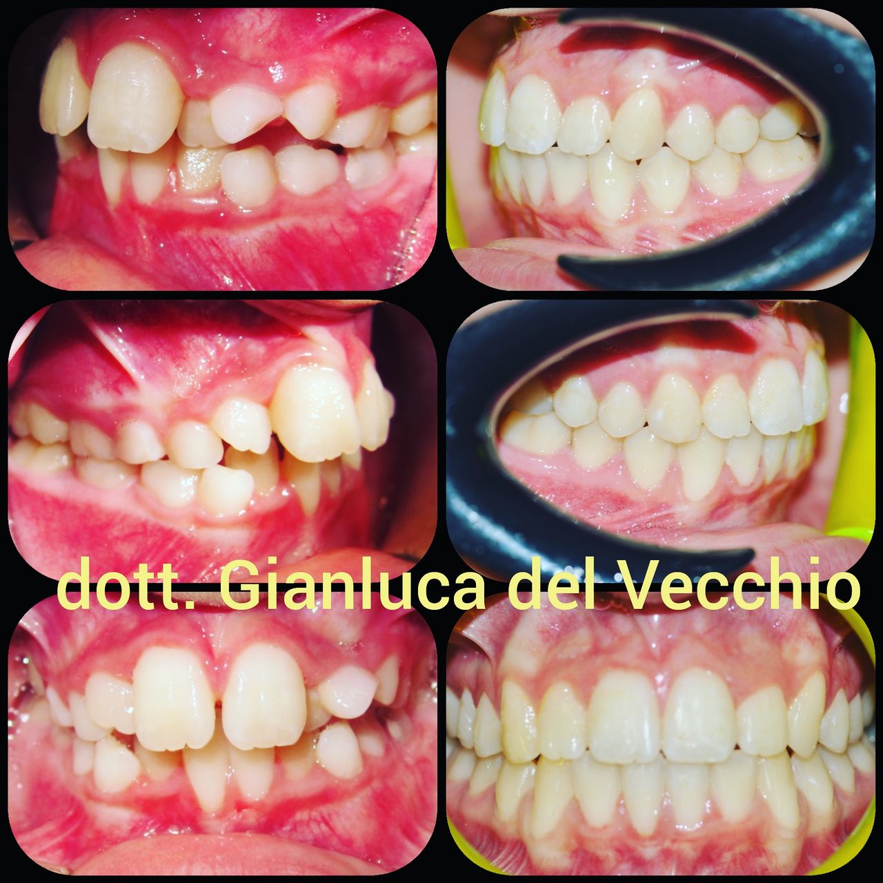 Gianluca Del Vecchio-30