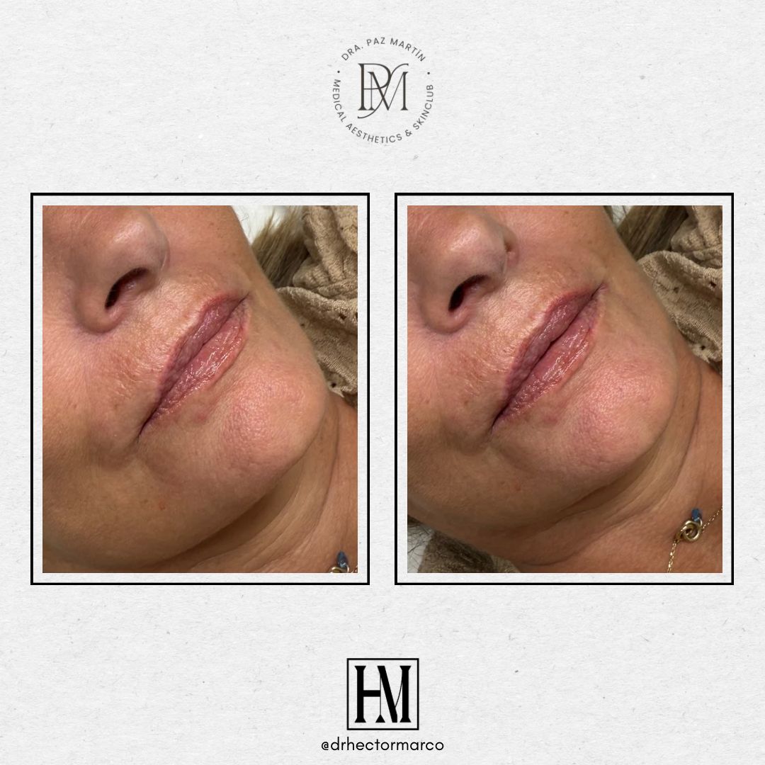 Héctor Marco Ruiz-7