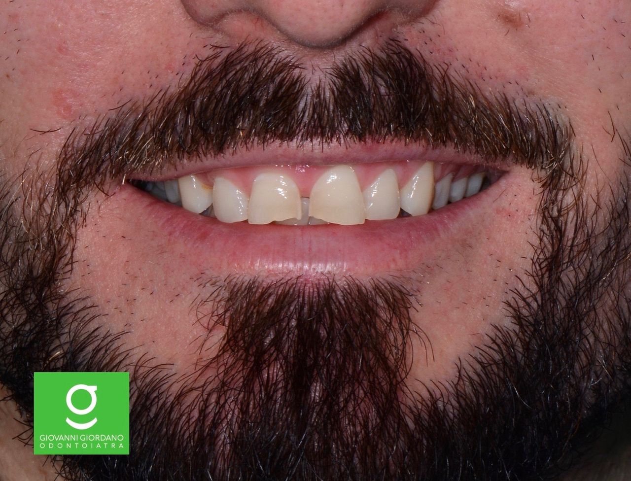 Giovanni Giordano-11