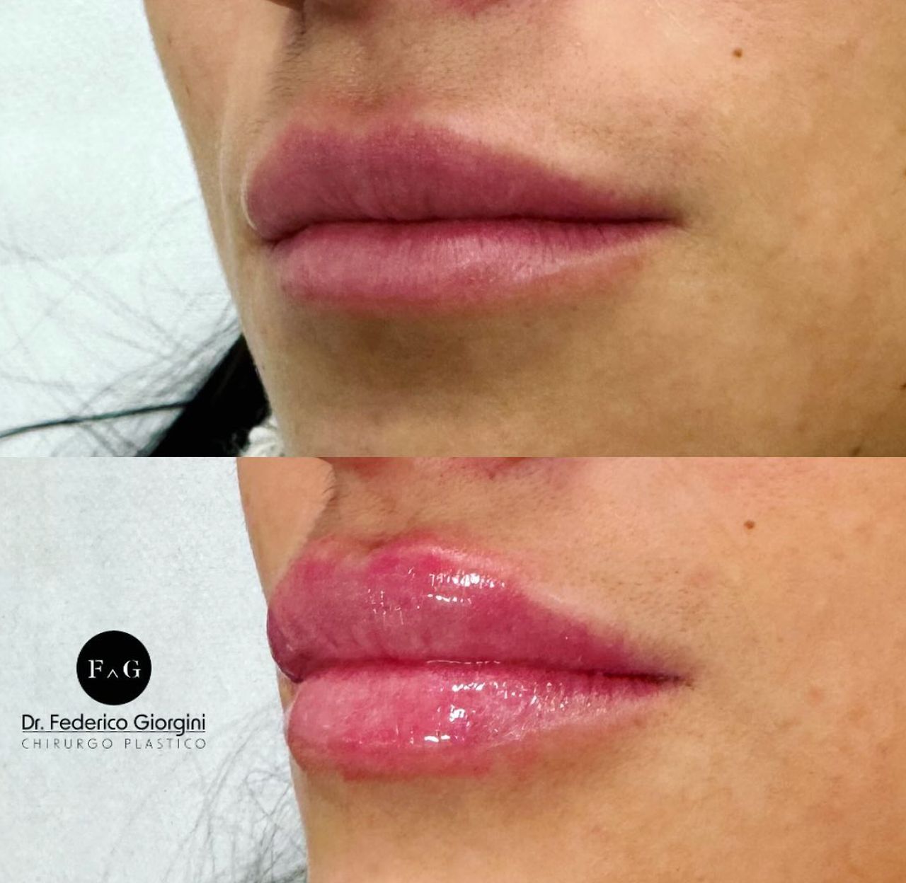 Federico Giorgini-21