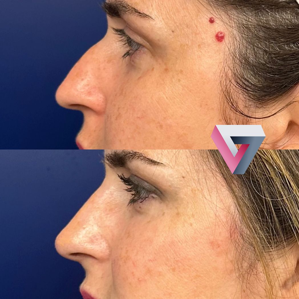 Victoria Trasmonte-96