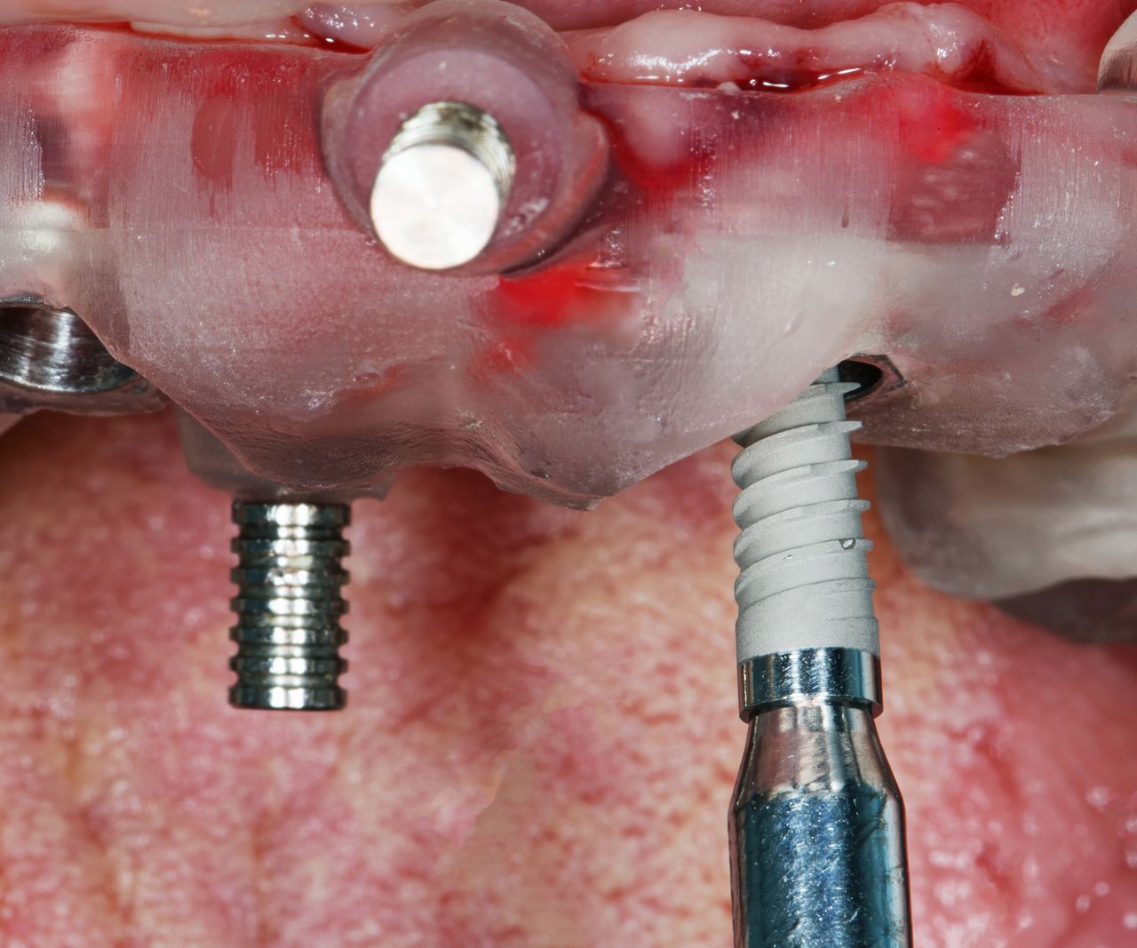 Francesco Carpenteri-12