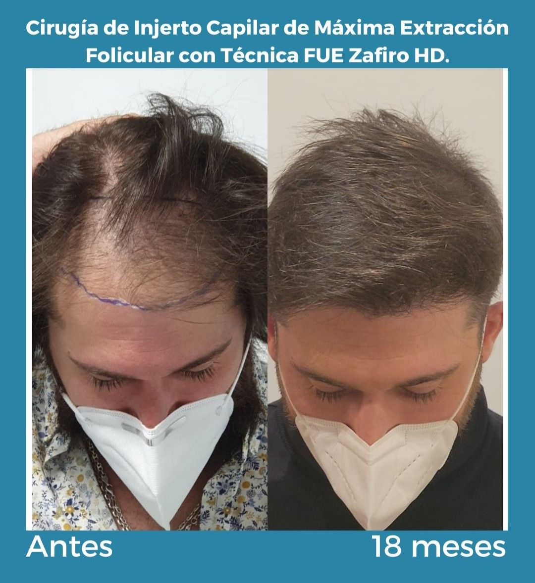 Antonio Fernández Brito-5