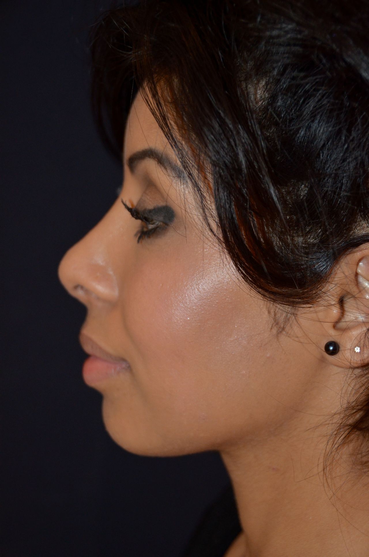 Christoffer Ingves-16