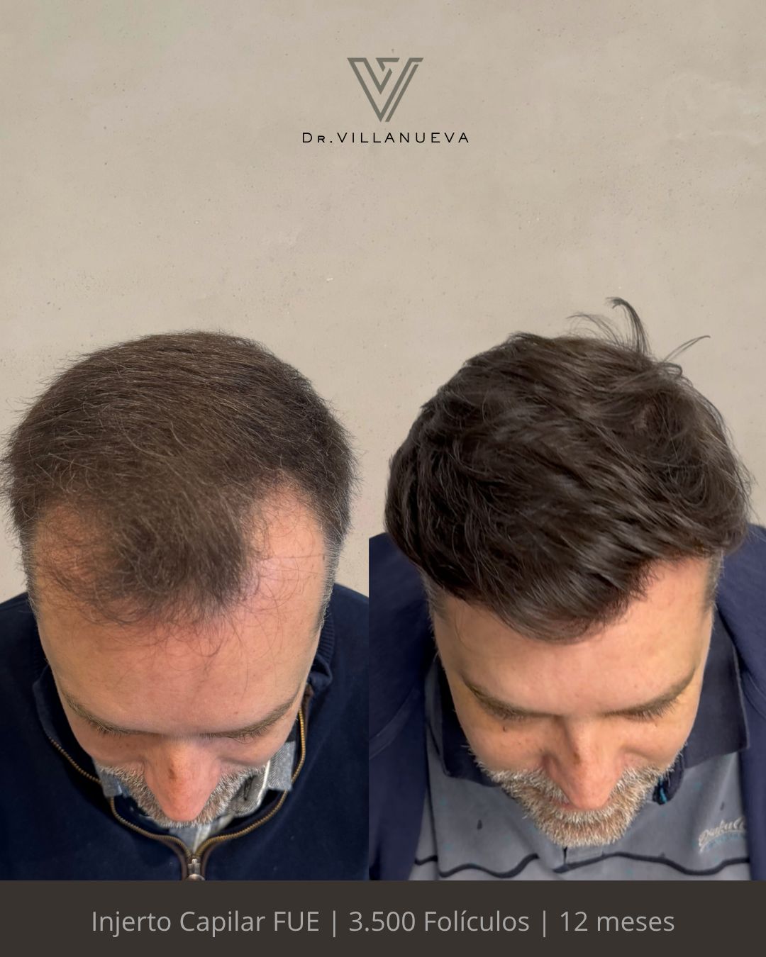 Alfredo Villanueva-2
