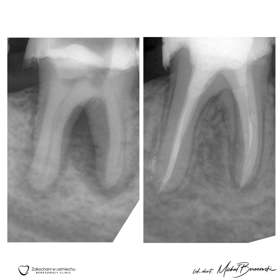 Michał Berezowski-28